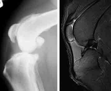 Dog knee radiograph