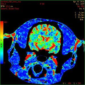 Dynamic perfusion CT (B)